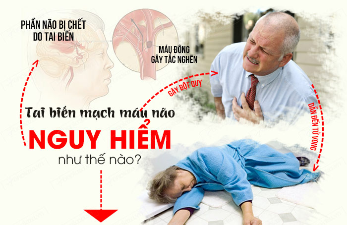 Tai biến mạch máu não để lại nhiều hậu quả nguy hiểm.